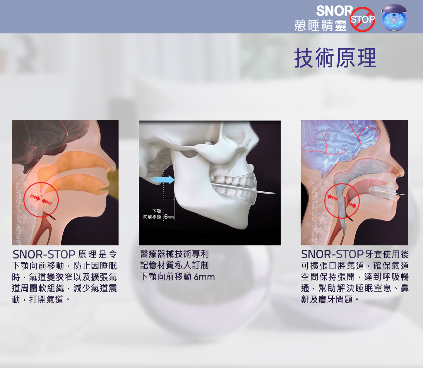 Snor-Stop 憩睡精靈