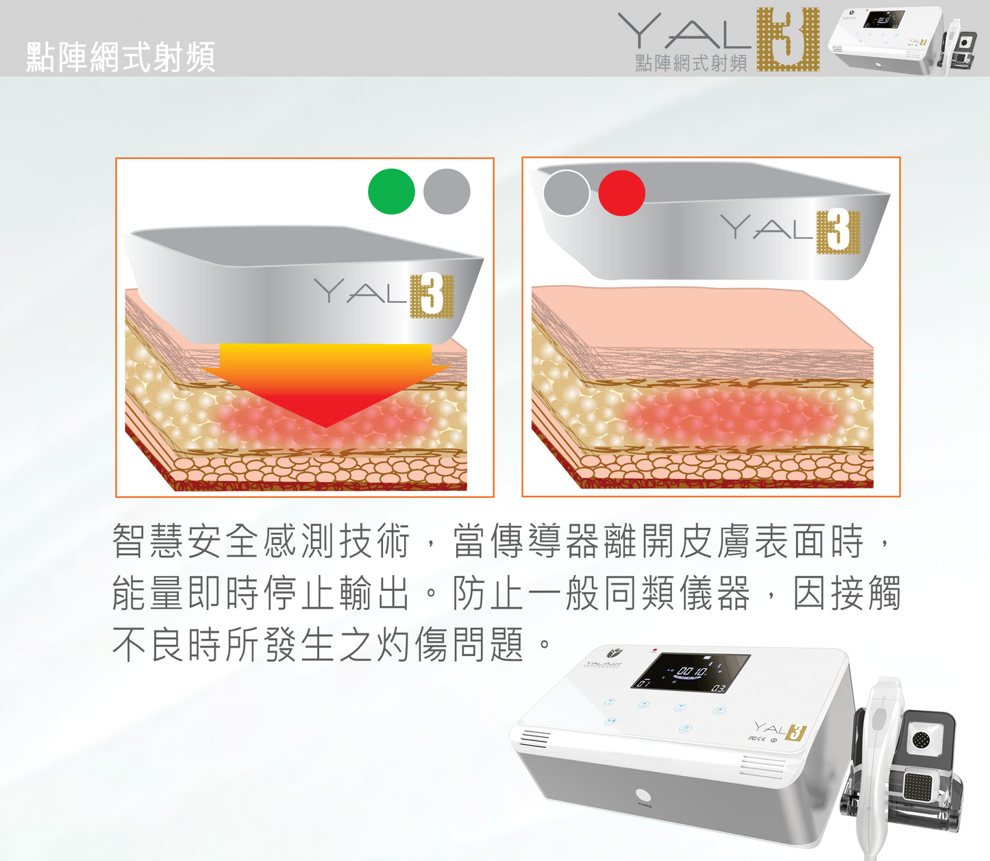 Yalart │YAL-3 點陣網式射頻